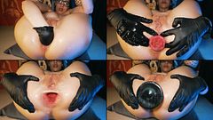 ANAL DESTROYED BUTT PLUG FISTING (Hardcore, Prolapse, Fisted, Gape, Teen, Gloves, Huge toy, Closeup)
